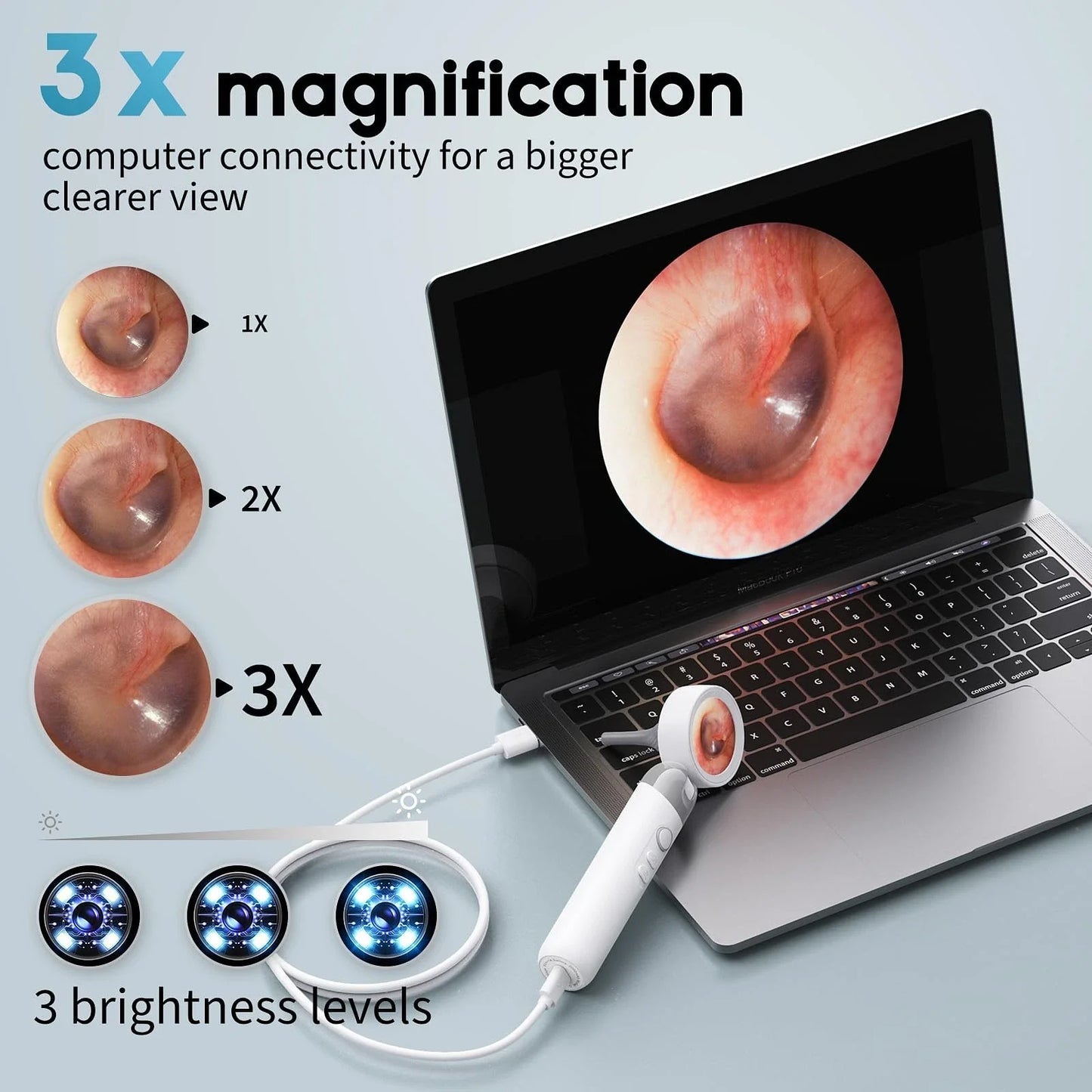 Smart Ear Scope – Ear Camera with Built-In Screen
