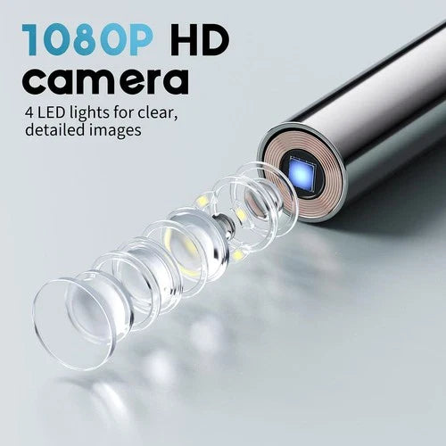 Smart Ear Scope – Ear Camera with Built-In Screen